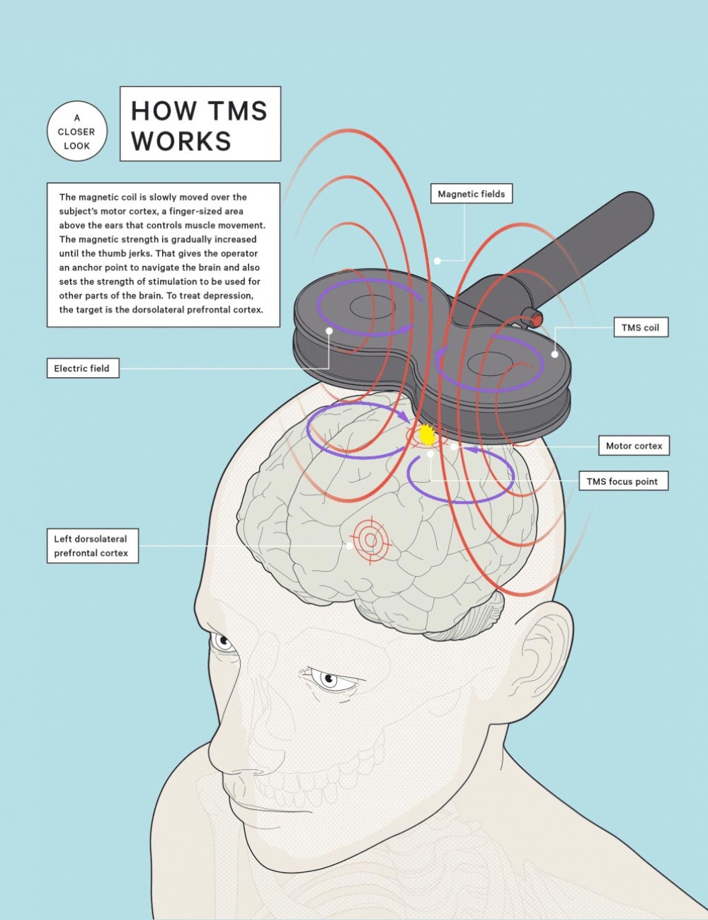 TMS Therapy | TMS Institute of Arizona